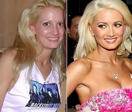 Holly Madison Before and After 