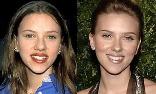 Scarlett Johansson Before and After 